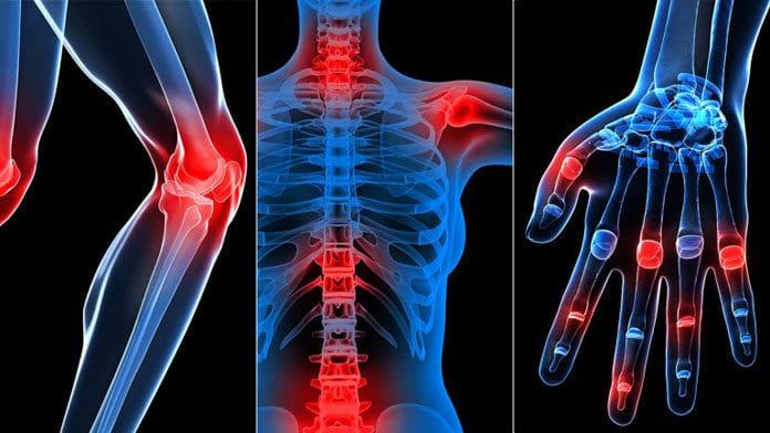 Osteoartrita cunoscută și ca artrită degenerativă